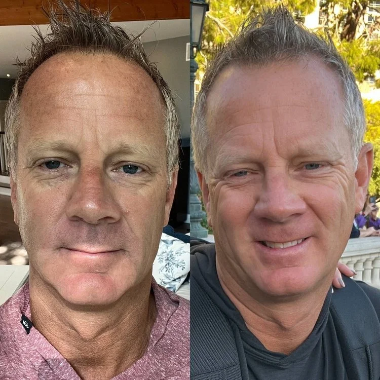 Customer before and after skincare result 5