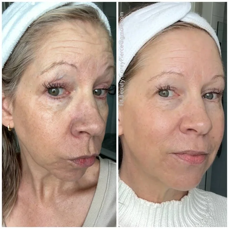 Customer before and after skincare result 6