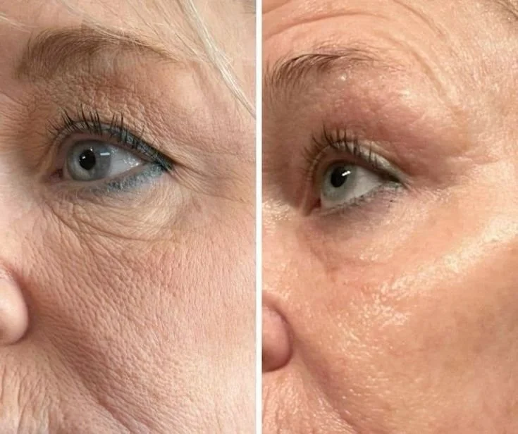 Customer before and after skincare result 4