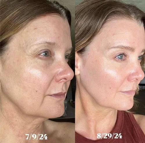 Customer before and after skincare result 8