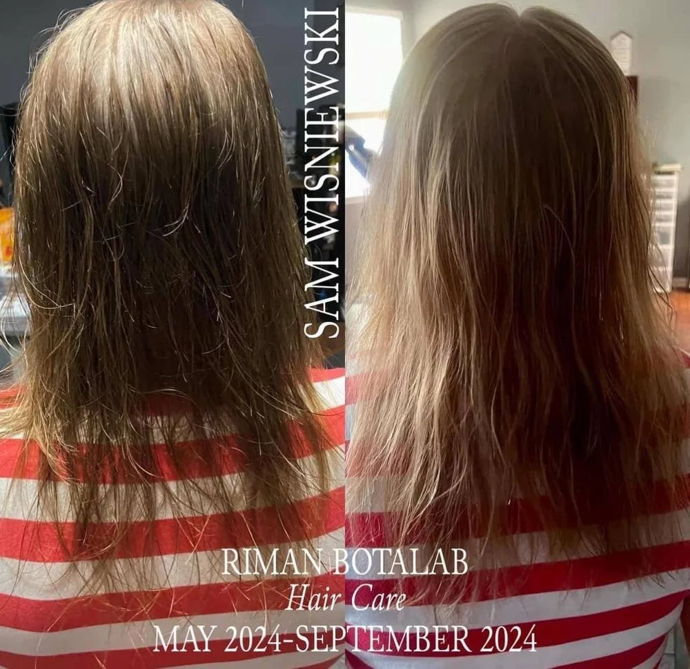 riman before after