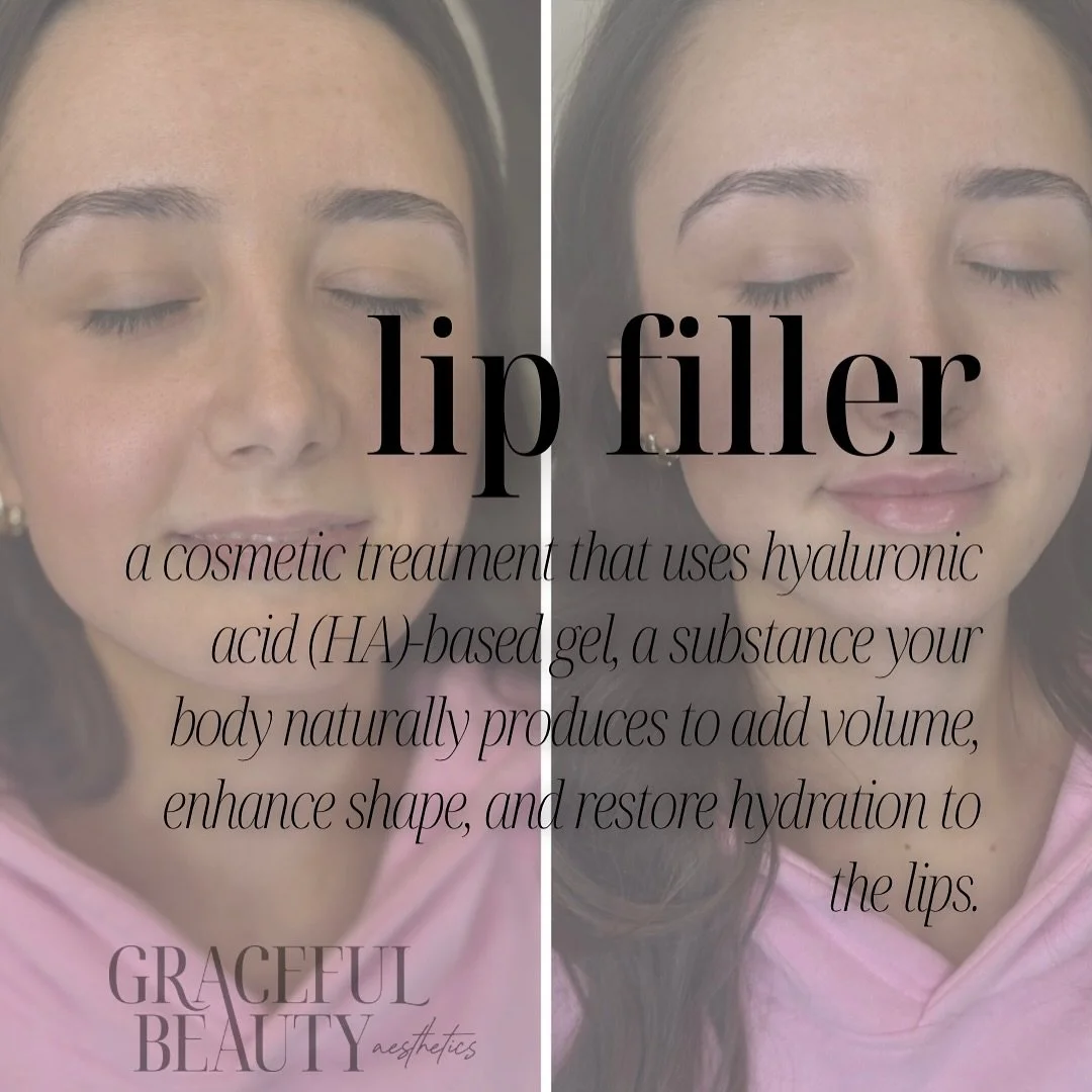 Questions about lip filler? Please reach out! We love hearing from you. 🫶🏼

📞 419-520-7127
🔗 Booking link in bio! 
🌐 GBAmedspa.com 

#OhioMedSpa #LipFillerEducation #OhioInjector #LipFillerDiscounts #MansfieldOH #FindlayOH #NovemberSpecials