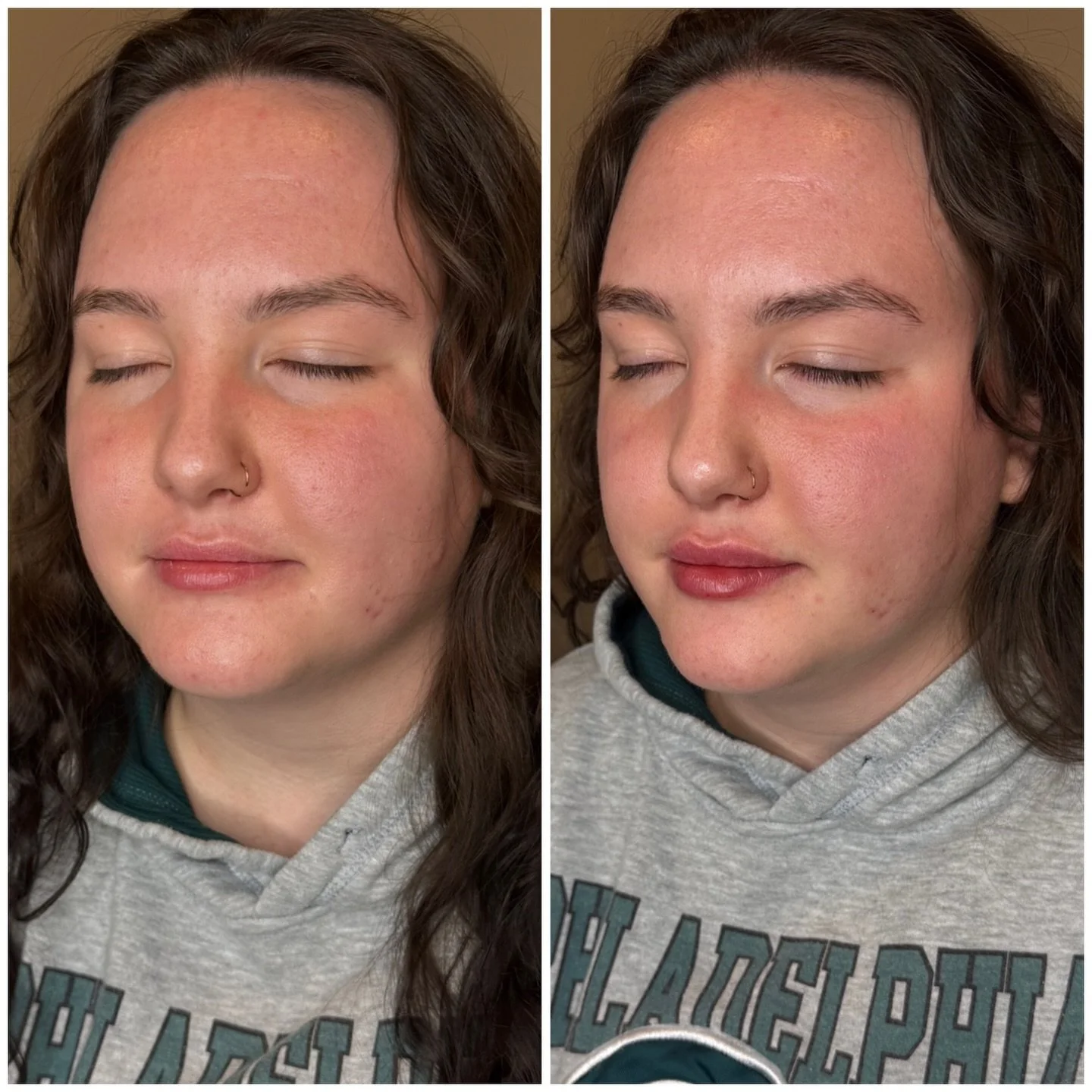 💋Shaping matters just as much as volume.

💉This half syringe was used to refine her Cupid&rsquo;s bow and pull the peaks into better harmony while restoring a gentle plump to the body of her lips.

💋Have questions about lip filler? Please always r