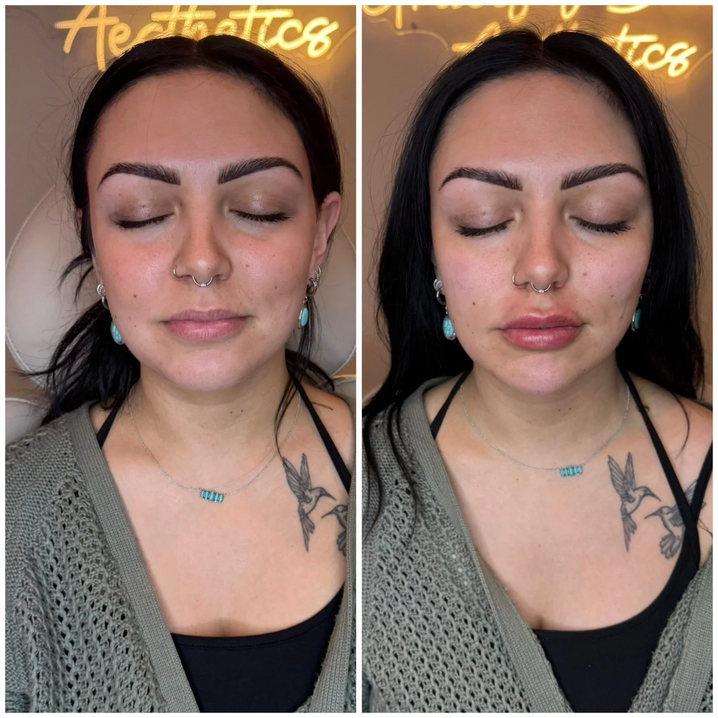 Just a little balance where it counts.
Lips, cheeks, and chin doing their thing 🤍

Ready for your own glow up?
📍 Mansfield + Findlay, Ohio
📲 Book through the link in our bio or send us a DM to get started.

#gracefulbeautyaesthetics #lipfiller #fa