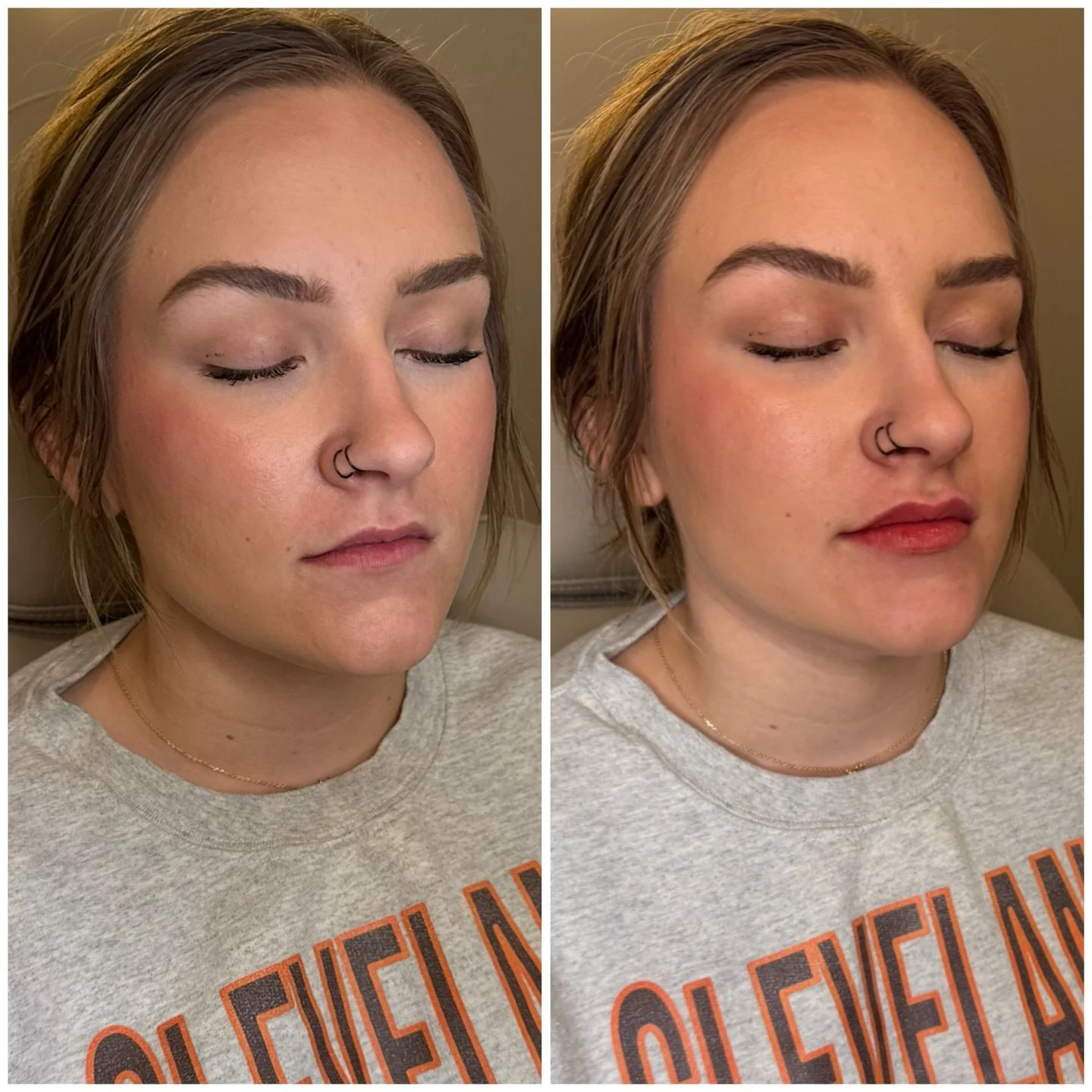 💋 Loved meeting this sweet girl for her FIRST lip filler appointment&hellip; and honestly, these are my favorite kinds of transformations.

We started super conservative with just 1/2 syringe to keep everything soft, natural, and balanced to her fac