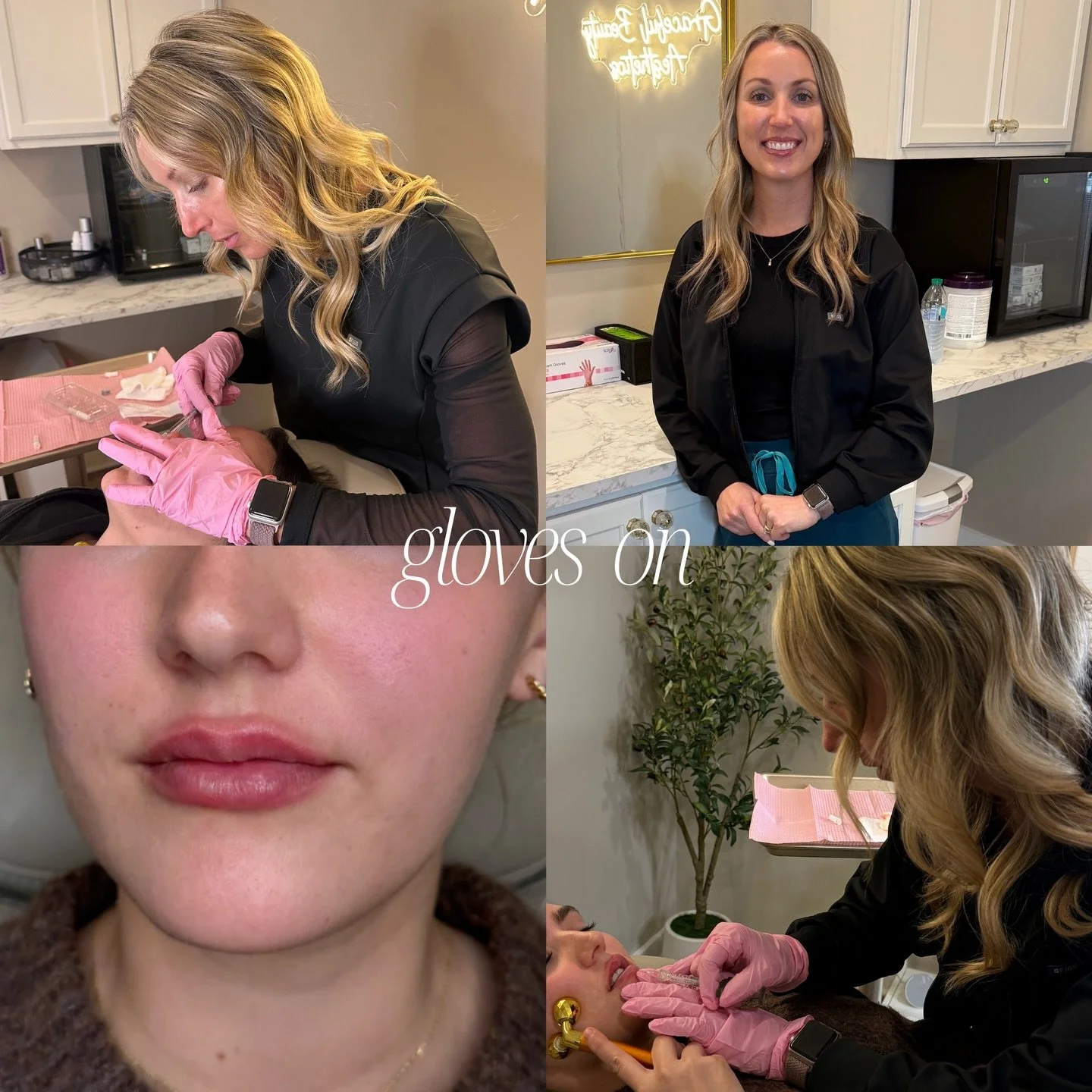 Emily Bowman, CNP
Nurse Practitioner | Aesthetic Injector 🤍

Gloves on- she&rsquo;s focused, precise, and making sure every little detail is just right. 💉✨
Gloves off- she&rsquo;s a mom, a sports sideline regular, and probably dreaming about her ne