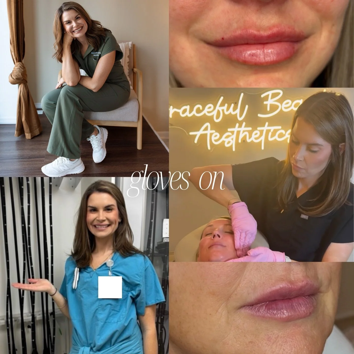 Gloves on&hellip; taking her time and caring for every detail. 💉
Gloves off&hellip; balancing more than most people could imagine. 🤎

Hospital nurse, Injector at GBA, being an amazing mom and wife, and currently in school for her BSN (graduating th