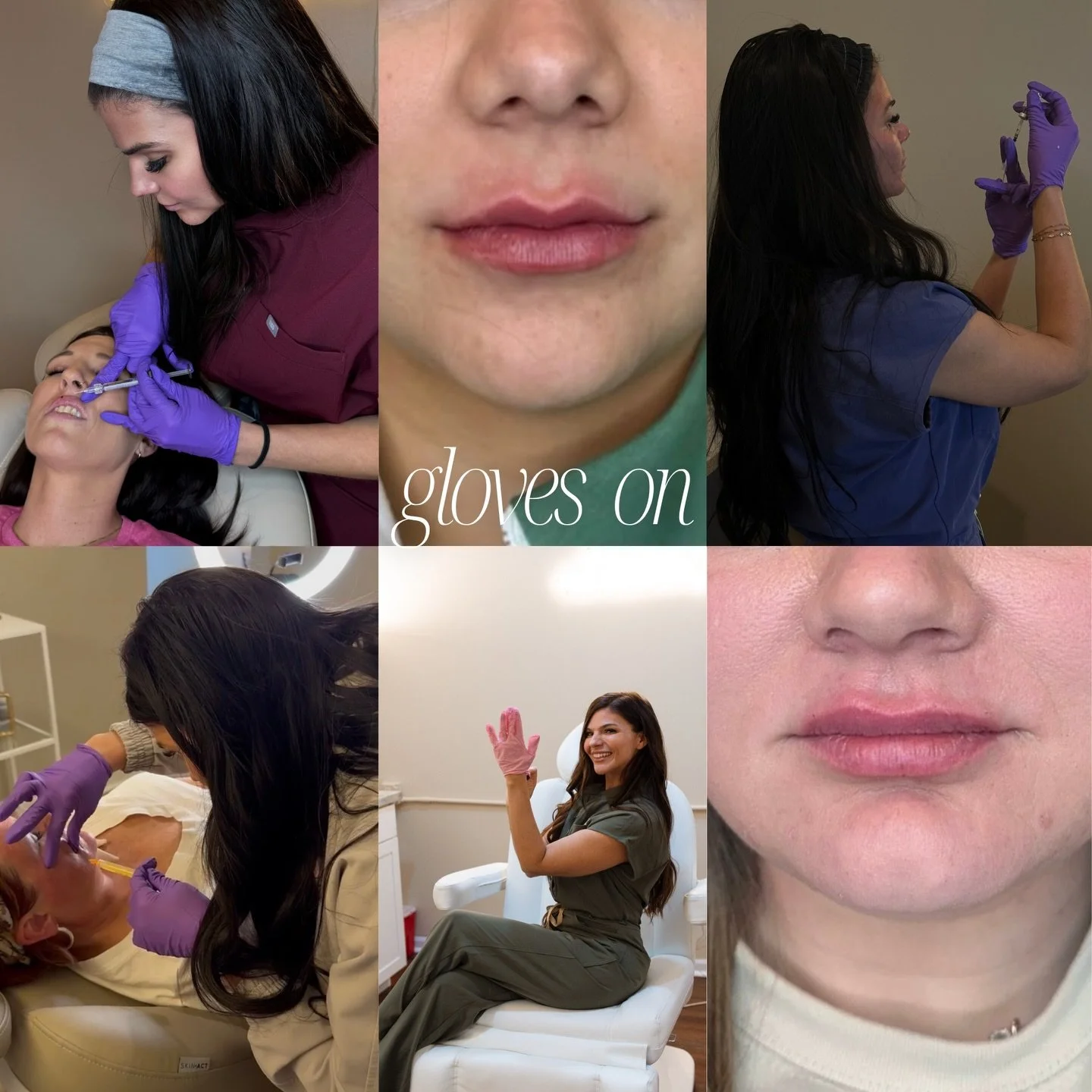 Brittany BSN, RN ✨

Gloves on, she&rsquo;s your go-to for natural, balanced results. She has a love for facial balancing, lip enhancement and all things Sculptra, Dysport &amp; Microneedling✨
(also your unofficial ZO skincare hype girl because she wi