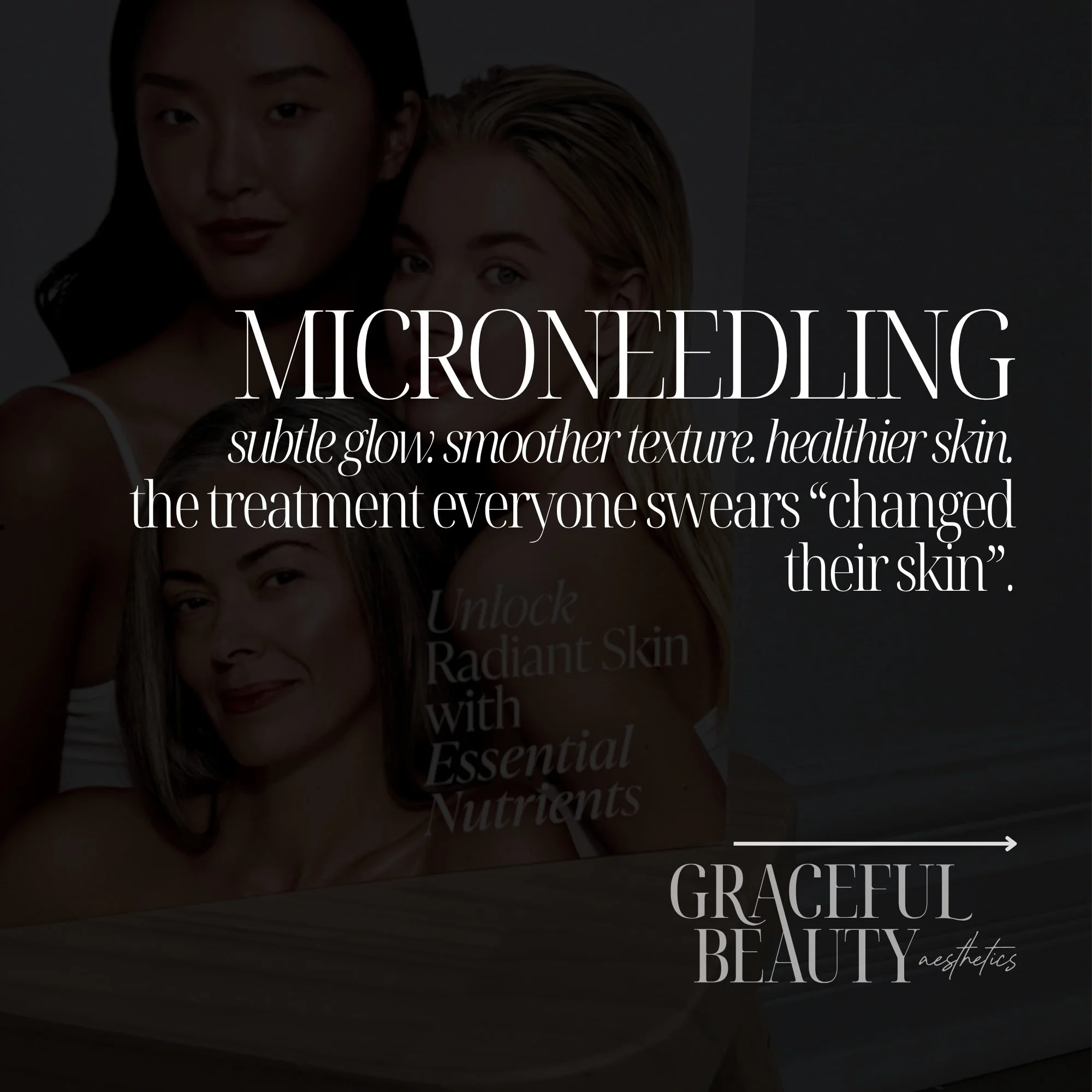 Microneedling is one of those treatments that quietly does ✨everything✨ for your skin over time.

🚨 AND&hellip; it&rsquo;s on sale this month! Microneedling + PRP: $350/session (regularly $500/session)🚨 
**Bank up to 3 session **
*Offer is NOT vali