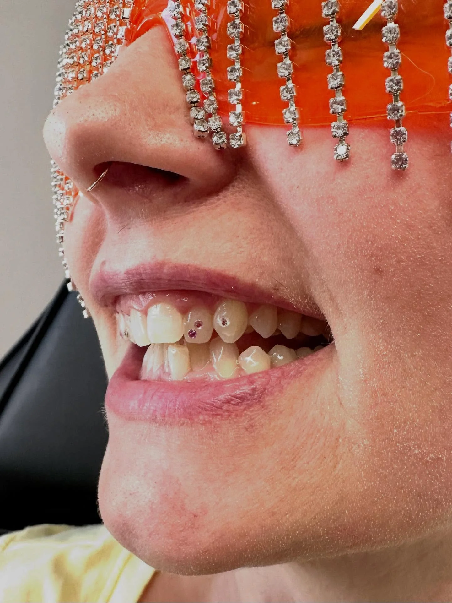 A lil pink and peach, two-on-one tooth combo for Carmen-ILY 💓🥳🍑

#toothgem #toothgems #toothgemwisconsin