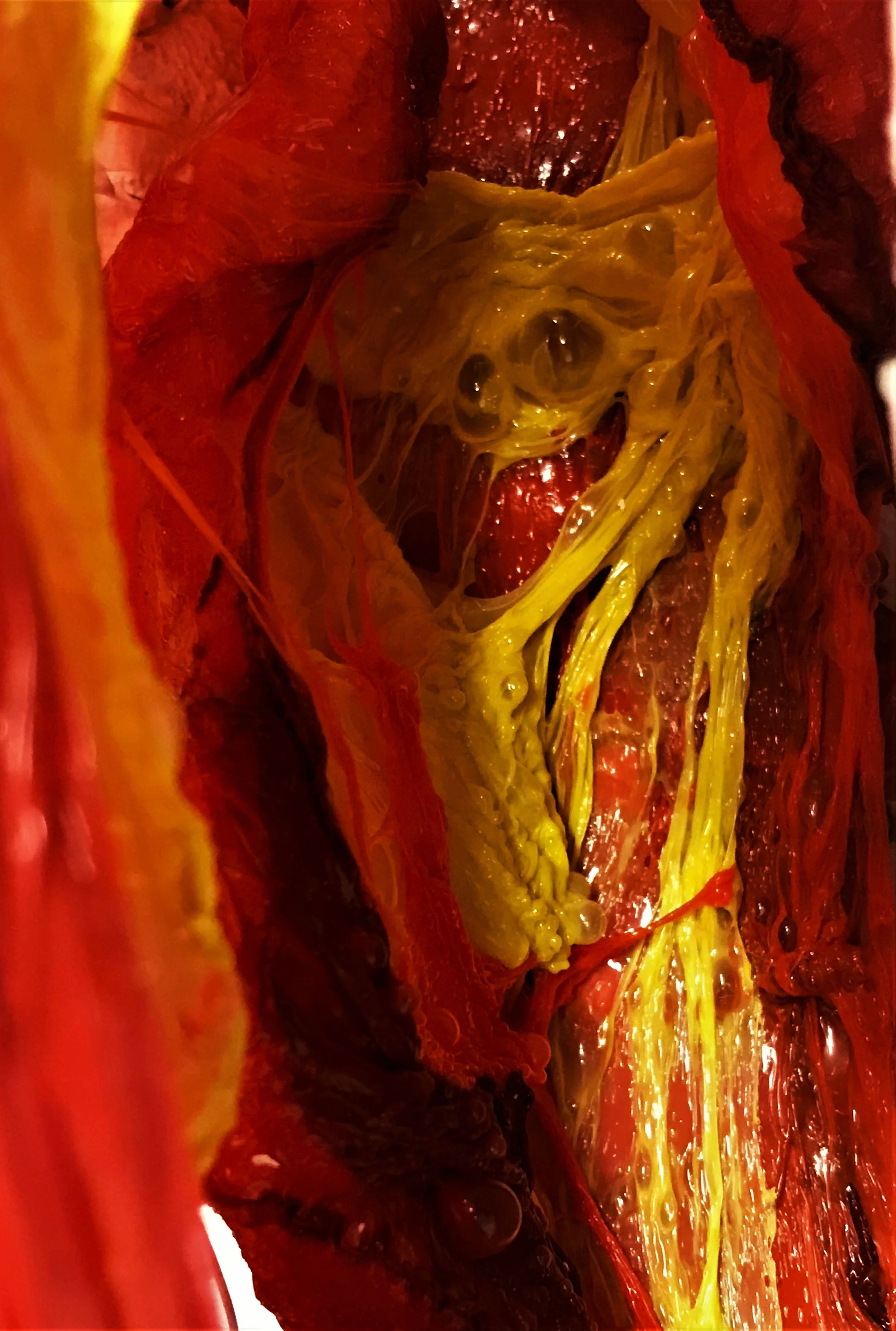Cellophane Wound 1
Melted cellophane