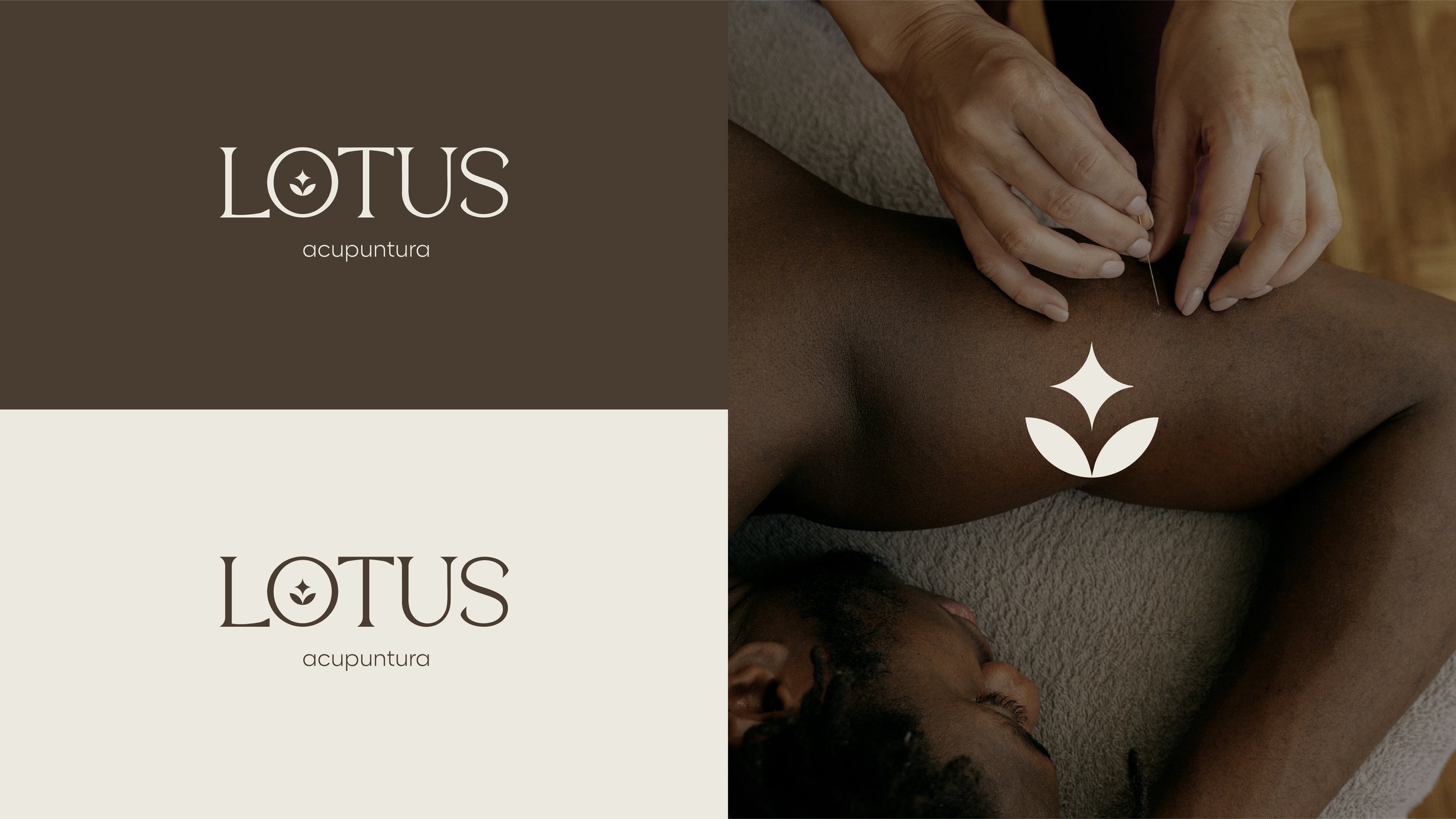 Lotus Acupuntura-02.jpg