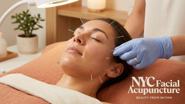 Does Facial Acupuncture Hurt in New York City? Honest Patient Experience