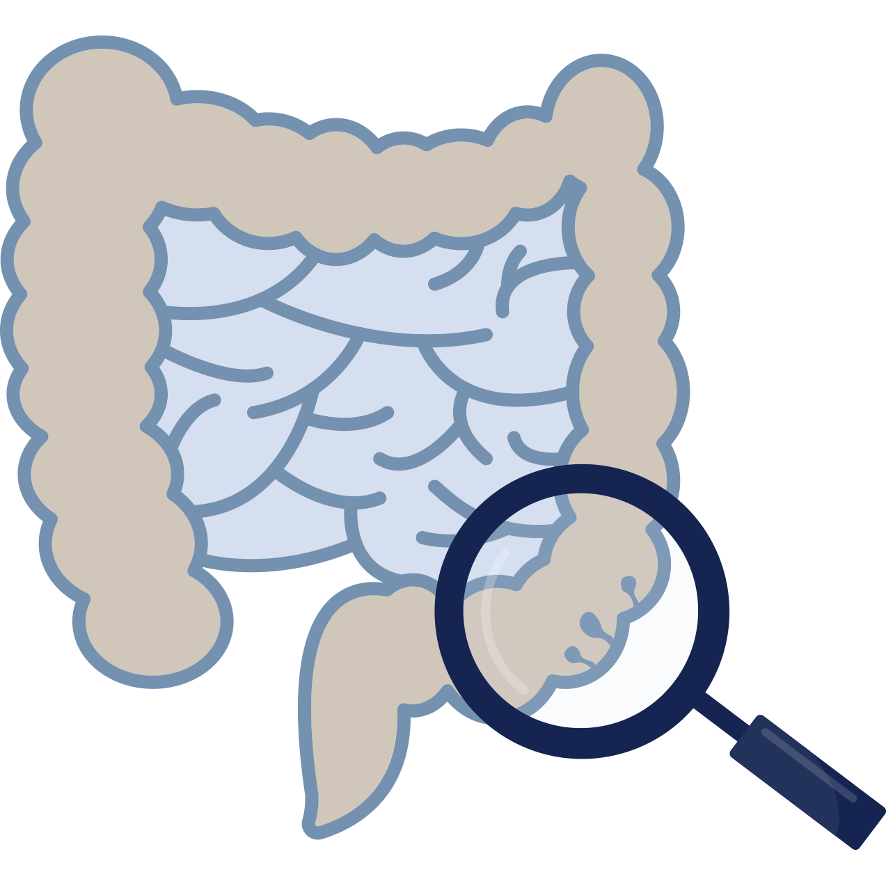 Bowel Polyps Gastrointestinal Polyps Treatments Melbourne Gastroenterology Endoscopy Dr Shane Selvanderan