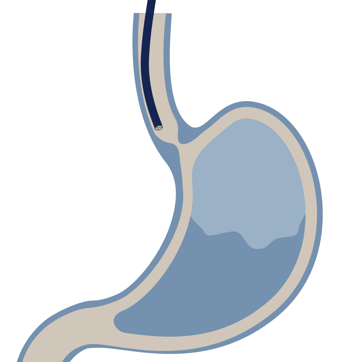 POEM by Dr Shane Selvanderan Gastroenterology & Endoscopy in Melbourne