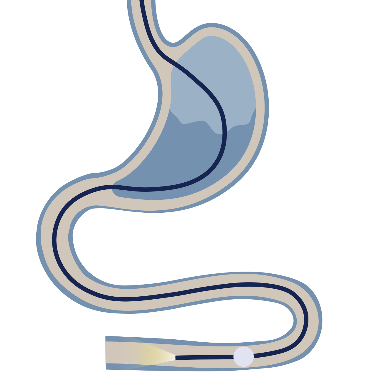 Balloon Enteroscopy by Dr Shane Selvanderan Gastroenterology & Endoscopy in Melbourne