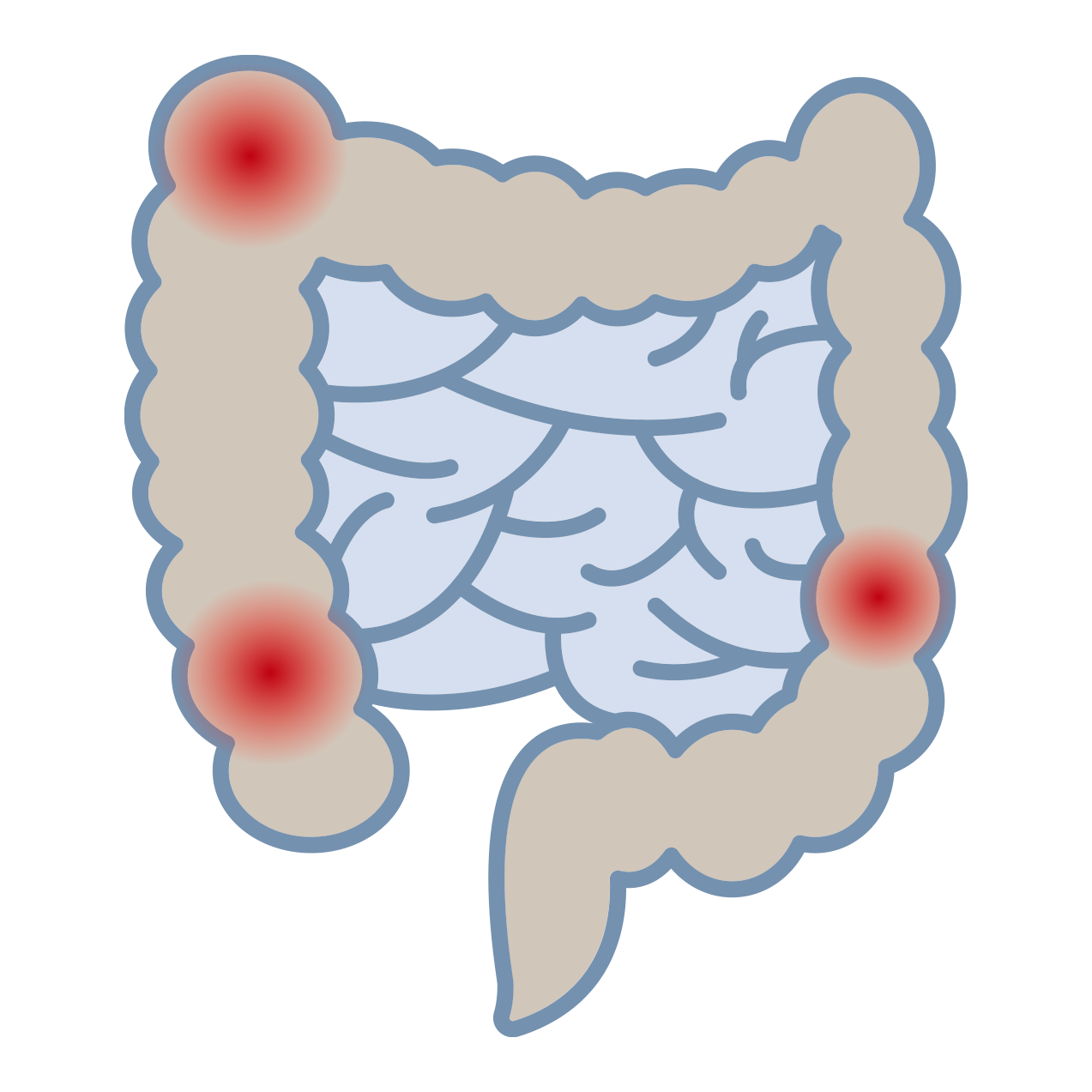 Irritable Bowel Syndrome IBS Treatment Melbourne Gastroenterology Endoscopy Dr Shane Selvanderan