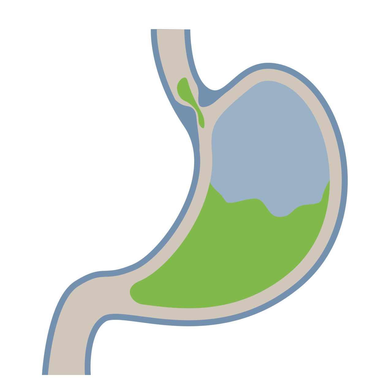 GORD Reflux Treatments Melbourne Gastroenterology Endoscopy Dr Shane Selvanderan