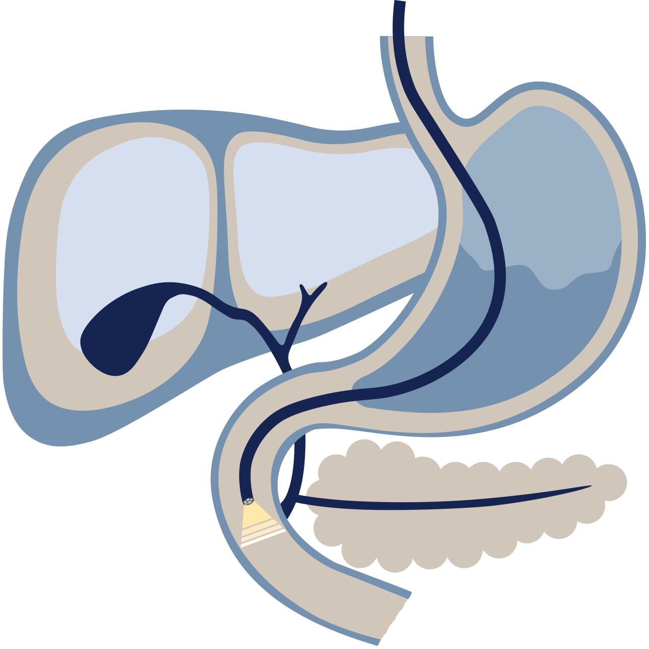 ERCP by Dr Shane Selvanderan Gastroenterology & Endoscopy in Melbourne