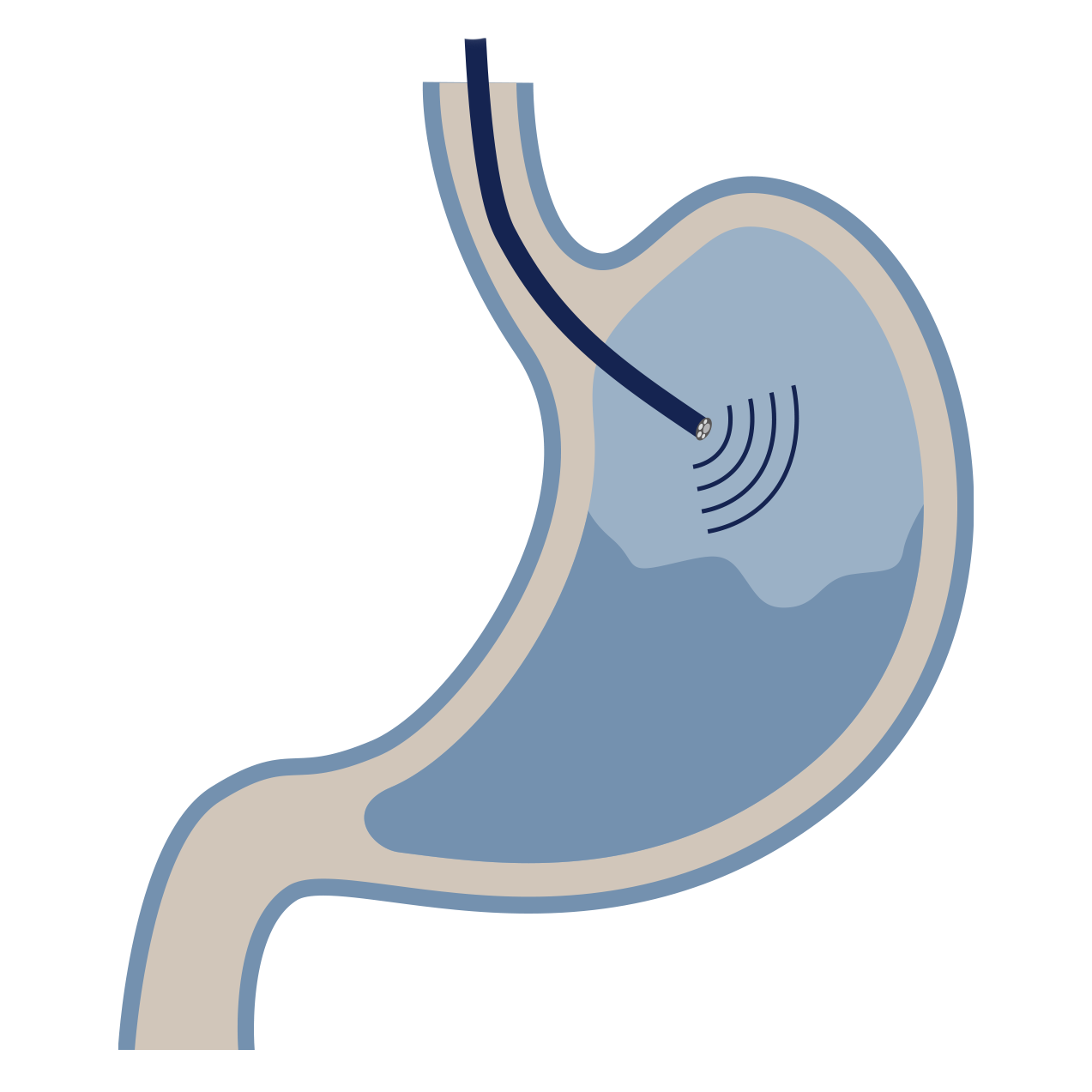 Endoscopic Ultrasound (EUS) services by Dr Shane Selvanderan Gastroenterology & Endoscopy in Melbourne