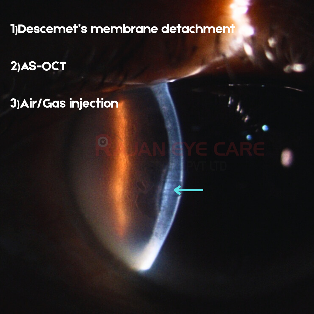 EyeSpy - DMD Answers.png
