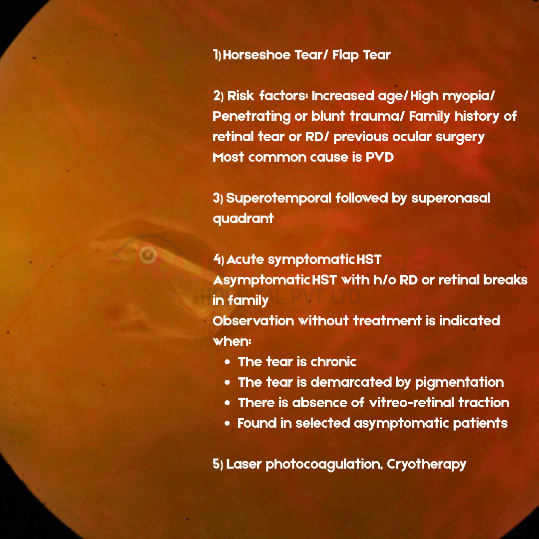 EyeSpy Answers- HST.png