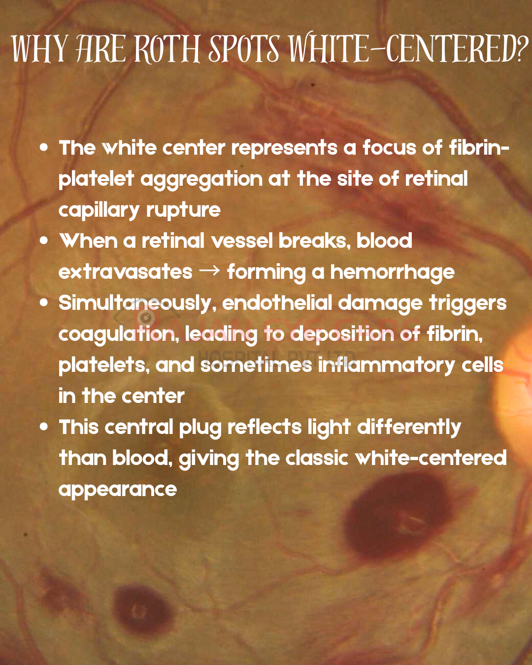 Why are Roth Spots white-centered?