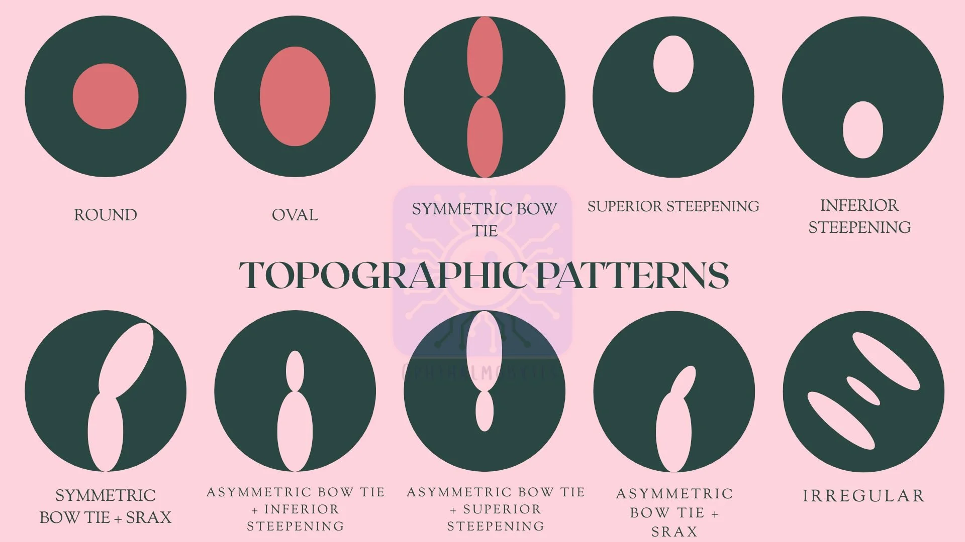Patterns seen on Corneal Topography