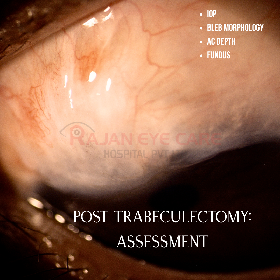 Post Trab: How to assess?