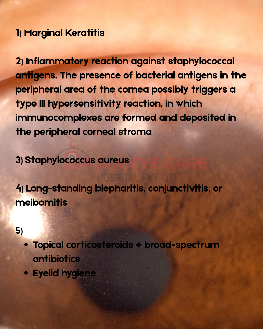 EyeSpy Answers Marginal Keratitis.png