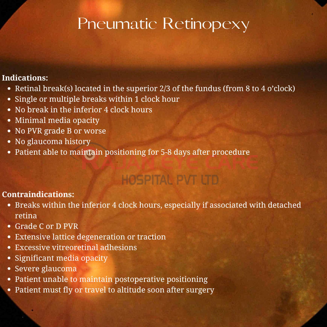 Pneumatic Retinopexy: Indications &amp; Contraindications