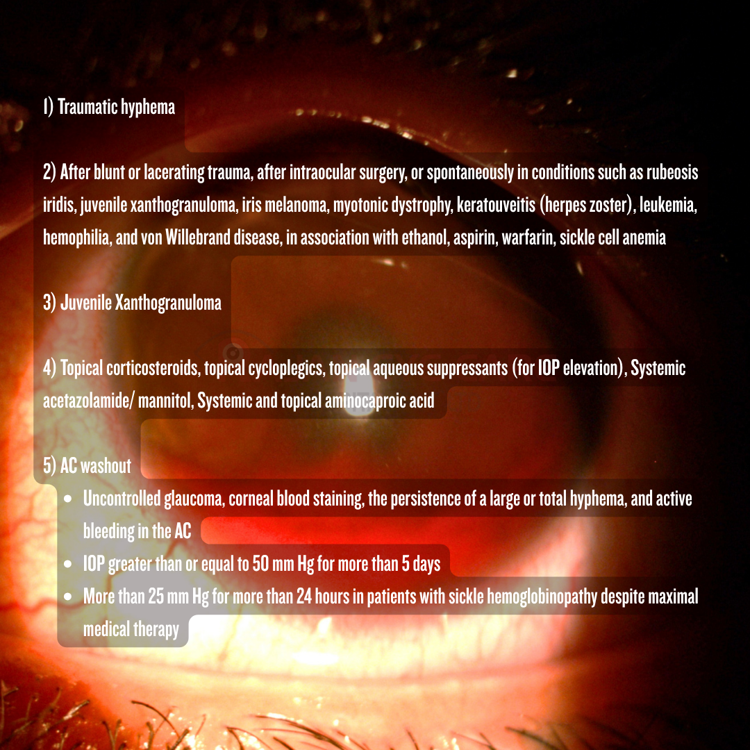 Hyphema EyeSpy answers.png