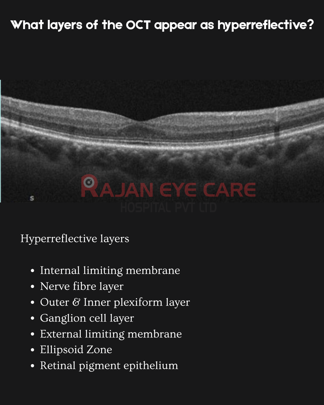Hyperreflective retinal layers in OCT