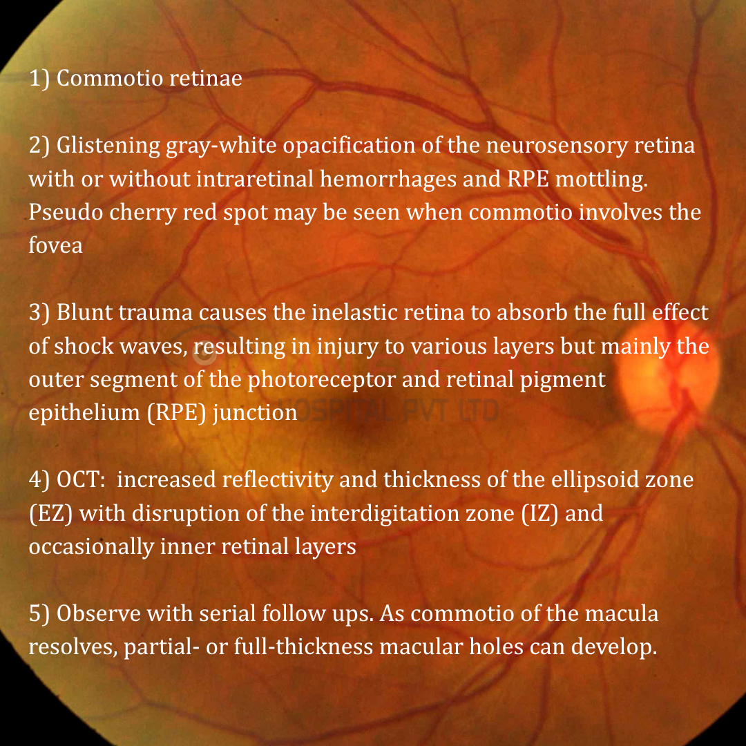 EyeSpy ANswers Commotio Retinae.png