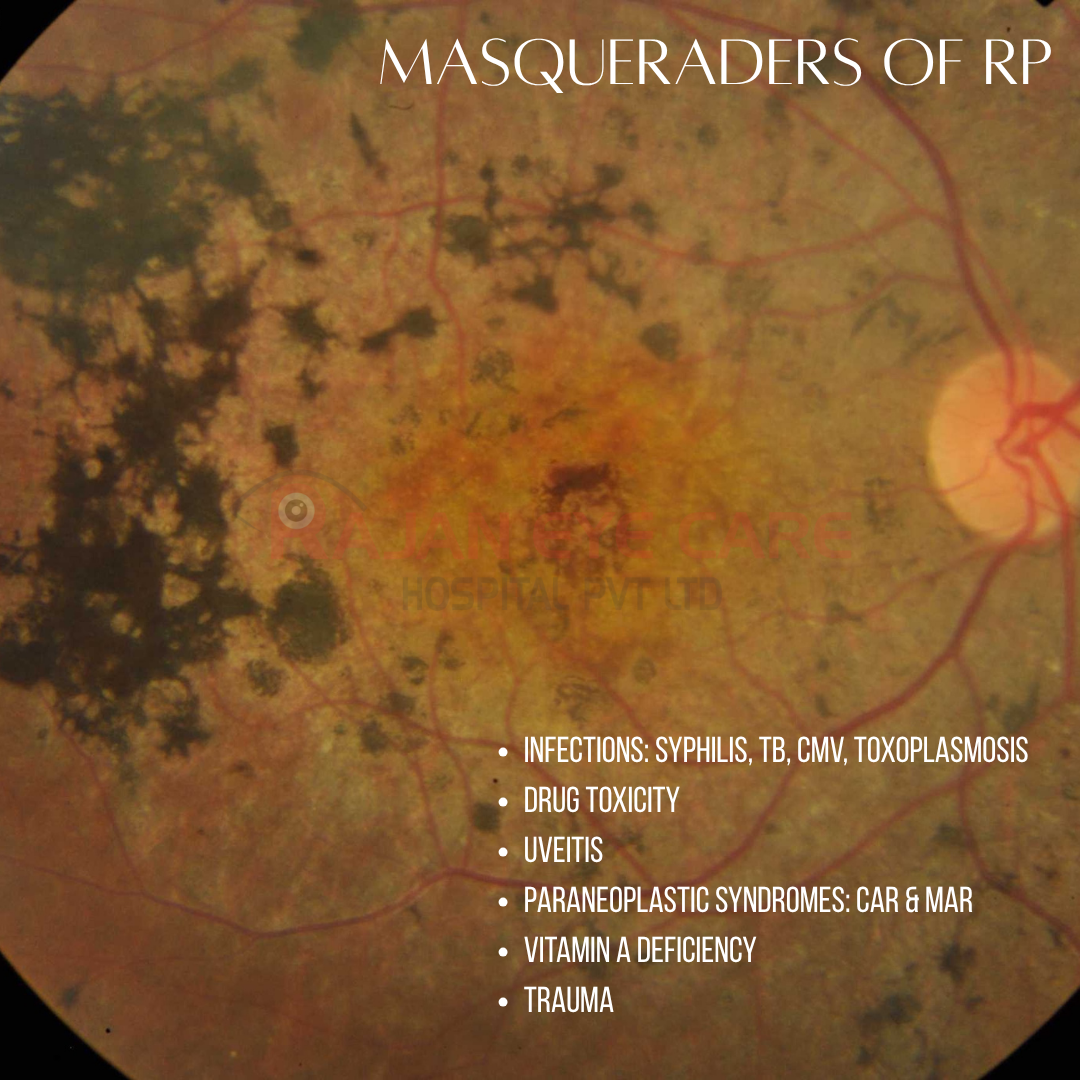 Masqueraders of RP