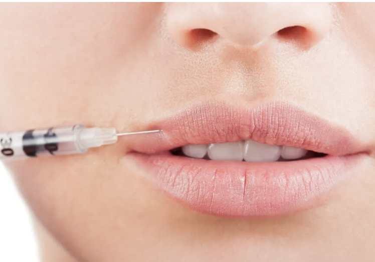 Close-up of a woman's lips receiving a cosmetic lip injection with a syringe.