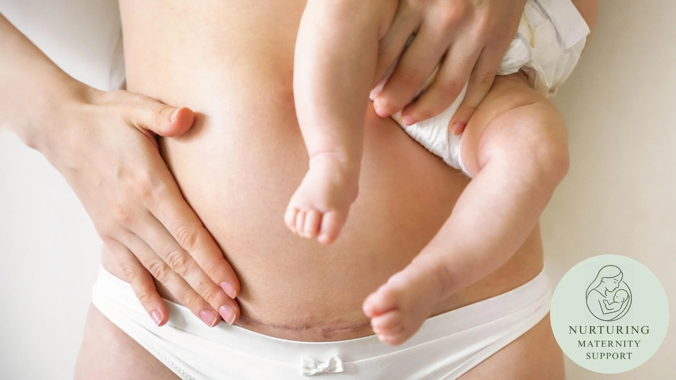 Mother with scar and baby