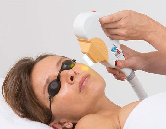 Épilation durable par Lumière Pulsée : Dites adieu aux poils indésirables !