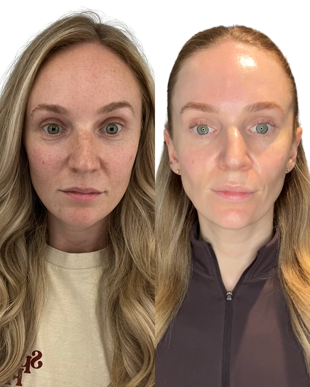 Multiple skin treatments 