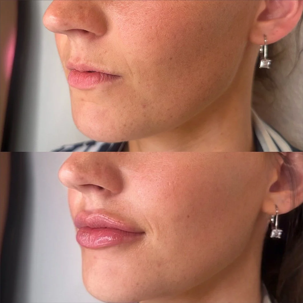 THE ART OF FACIAL CONTOURING
