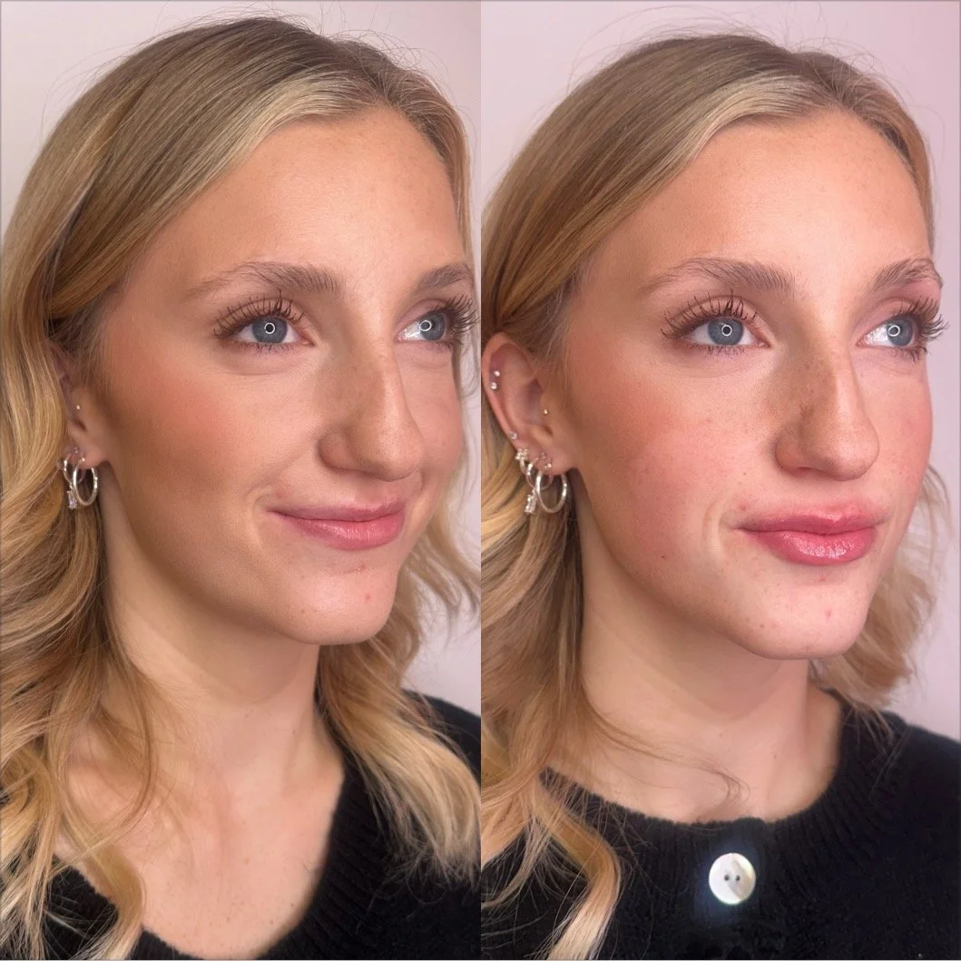 Facial Balancing and Our Full-System Approach