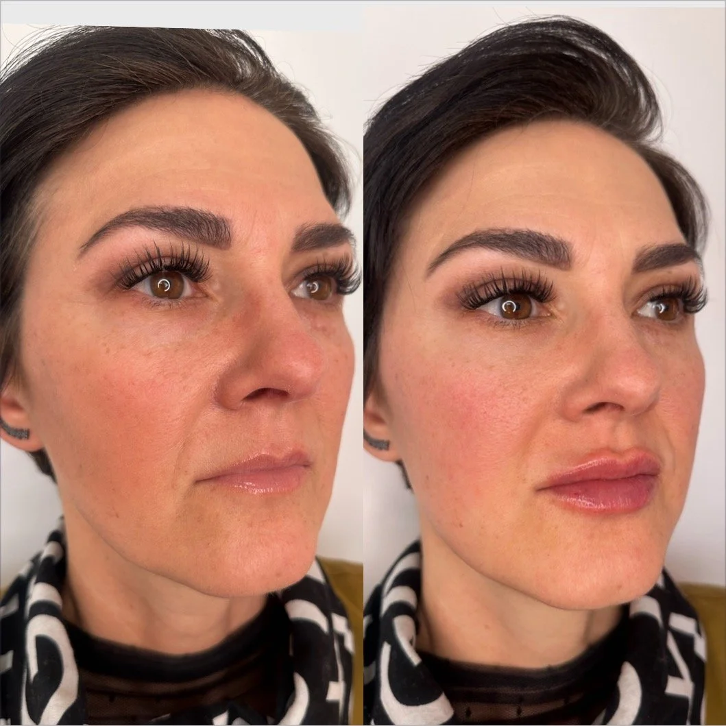 Why natural results come down to technique