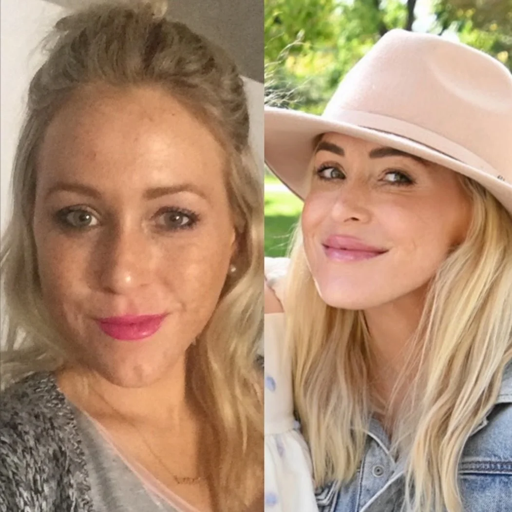 Social media has a way of making aesthetics feel way too simple.

Want more lift? Do this. Want better skin? Try that. Want to look younger? Apparently there&rsquo;s one treatment for that too.

But that&rsquo;s not really how good aesthetics works.
