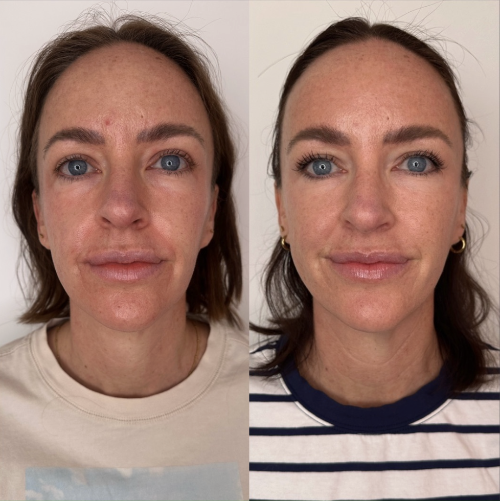 Regenerative Aesthetics is Having a Moment