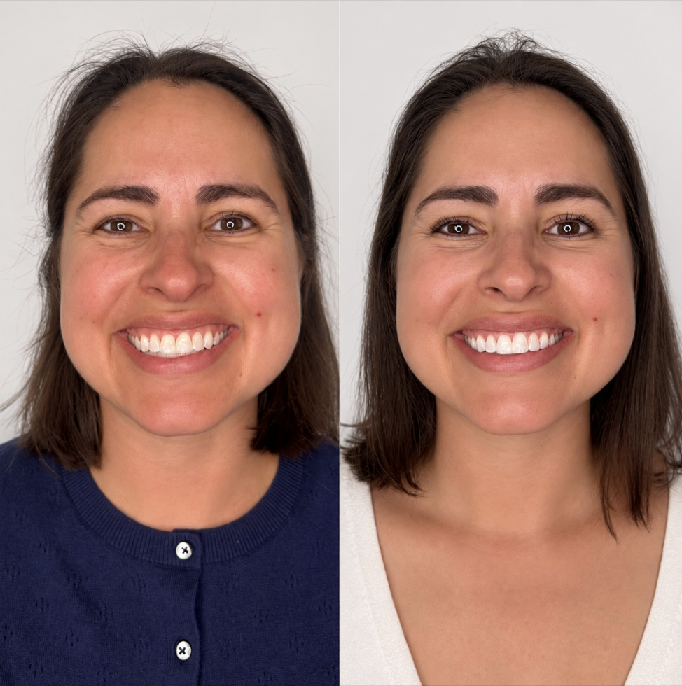 The Post-Summer Skin Reset