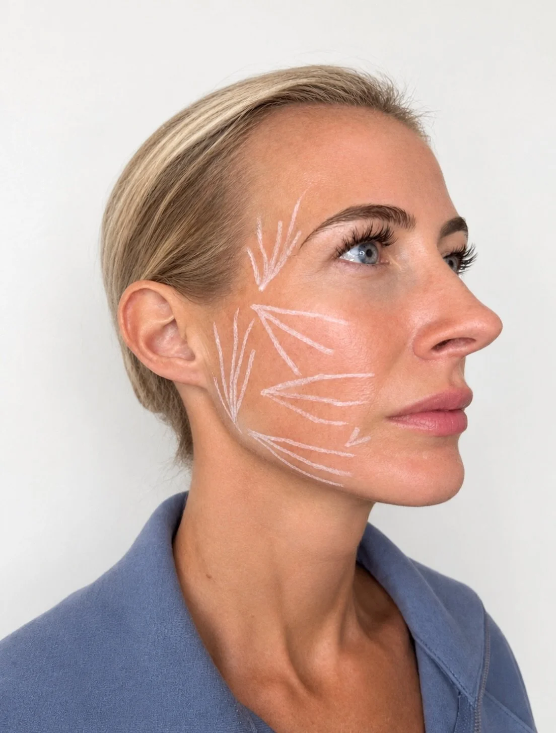 sculptra isn&rsquo;t a one vial and done treatment. it&rsquo;s about a plan, strategic placement, multiple sessions, and giving your body time to gradually rebuild collagen and restore volume. we are playing the long game here, and that&rsquo;s where