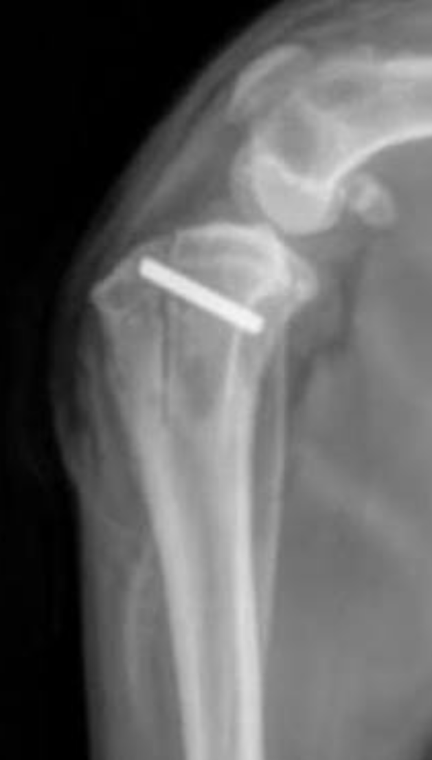 Postoperative canine knee X-ray after patellar luxation repair