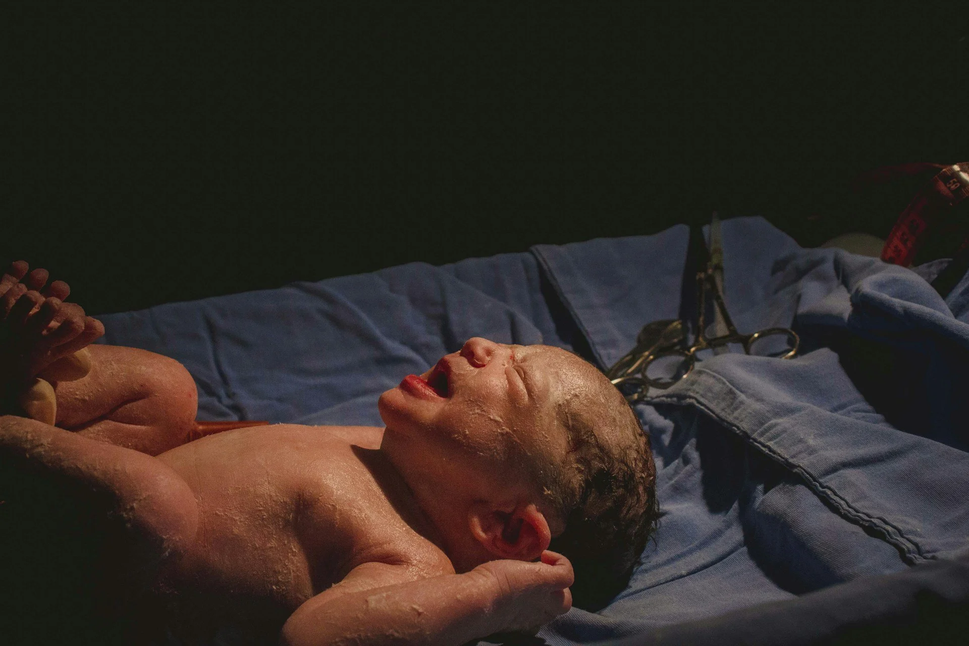 Common Concerns Parents Have About Baby Circumcision in South England