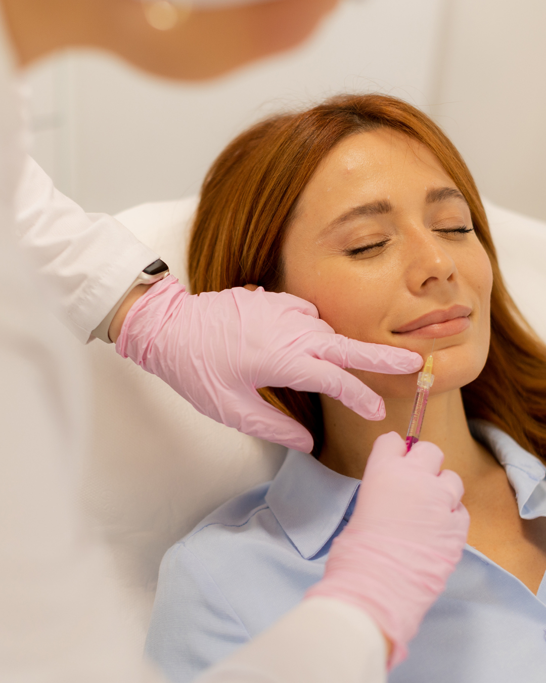 Lip Fillers: What to Expect, and How to Prepare for the Best Results