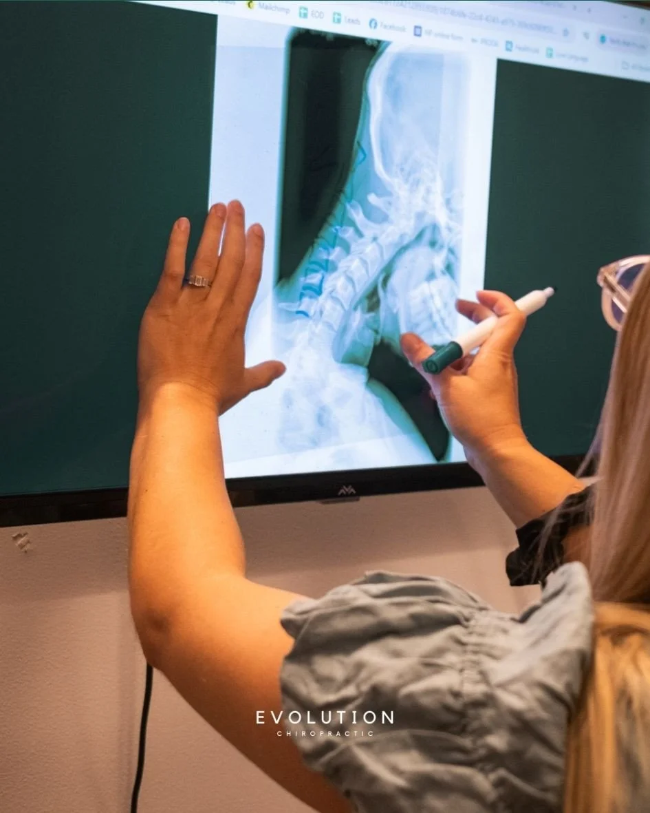 When clinically indicated, x-rays can give us important information about spinal alignment, bone health, and joint function &mdash; helping us make more informed decisions about your care.⁠
⁠
It&rsquo;s one of the ways we stop the guesswork and ensur
